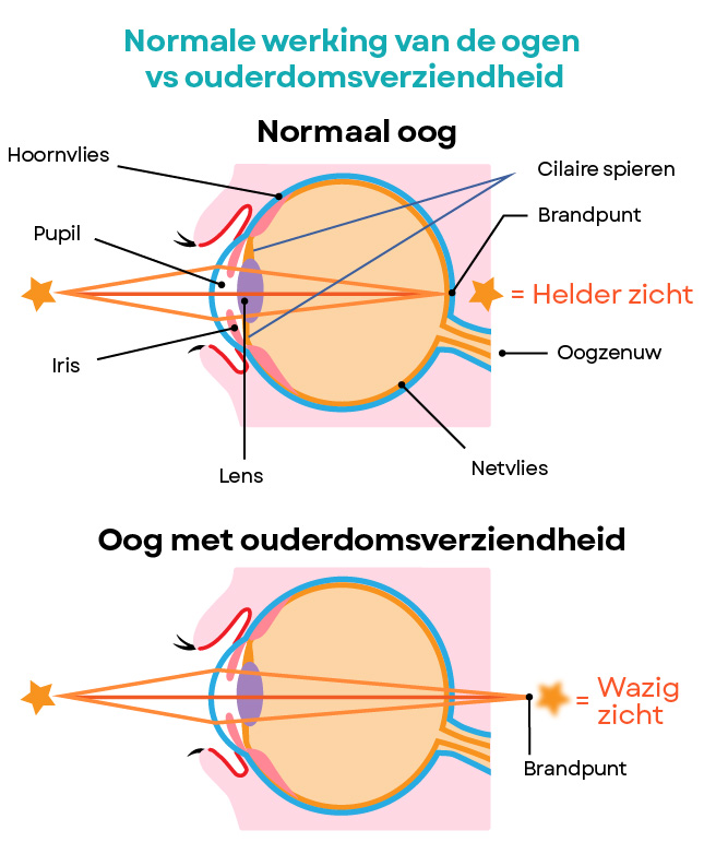 normale werking van het oog vs ouderdomsverziendheid